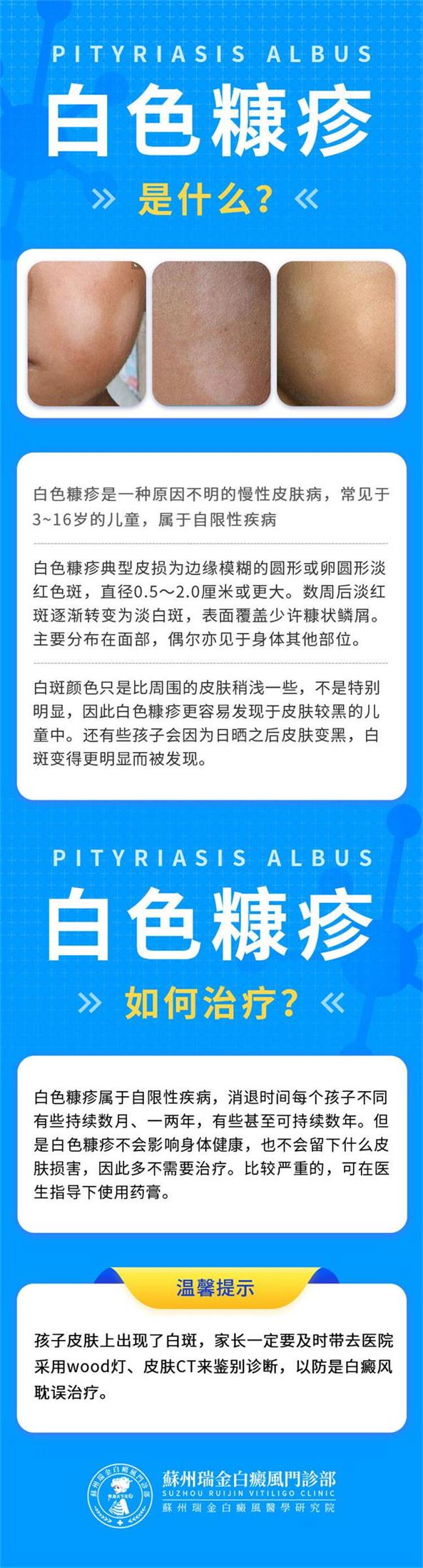 苏州瑞金白癜风医院