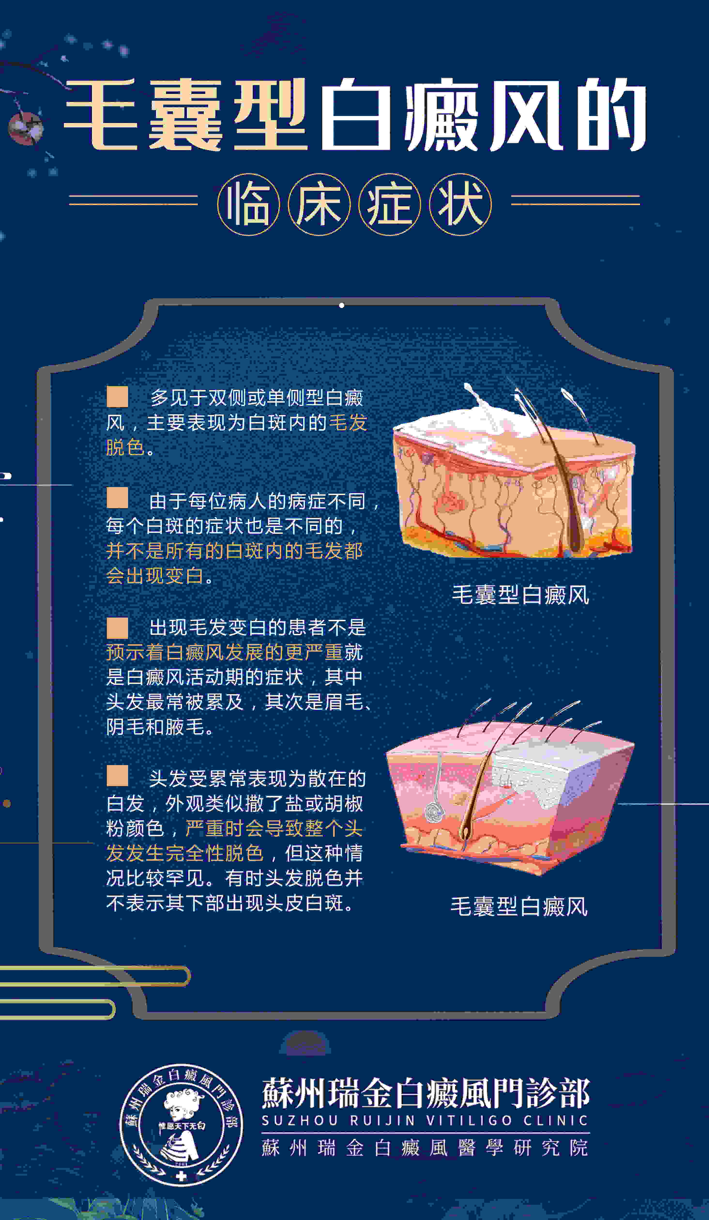 苏州瑞金白癜风医院